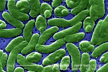 Bacteria grouping vibrio photo