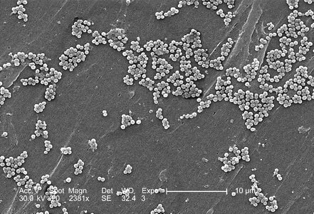 Bacteria electron electron micrograph
