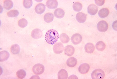 Crescent photomicrograph plasmodium