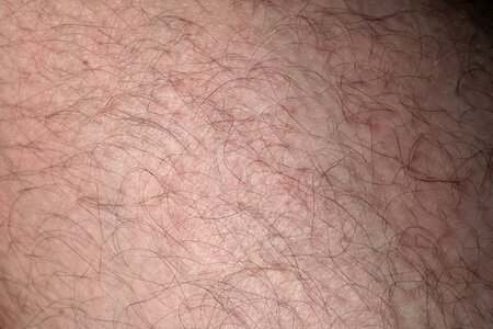 Leg leg hair human photo