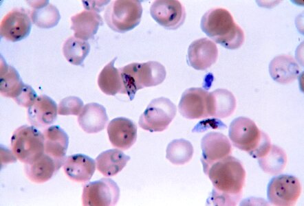 Film plasmodium ring photo