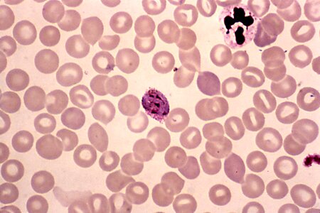 Blood Agar blood analysis chromatin photo