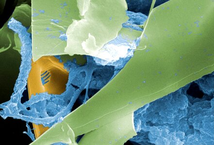 Electron electron micrograph empty