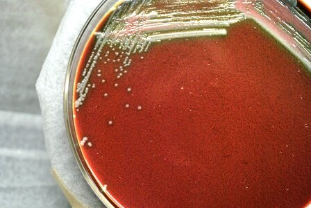 Bacteria blood colonial photo