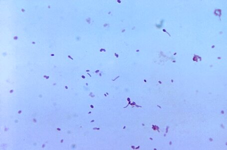 Bacteria blood blood agar