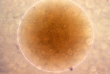 Bacteria cell colony photo