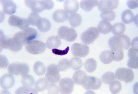 Film gametocyte plasmodium photo