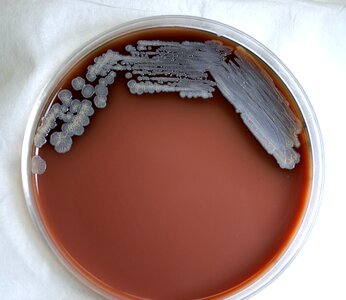 Bacteria gram negative photo