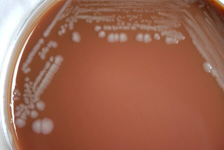 Bacteria cause contact photo