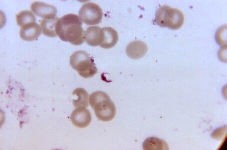 Gametocyte morphology photomicrograph photo