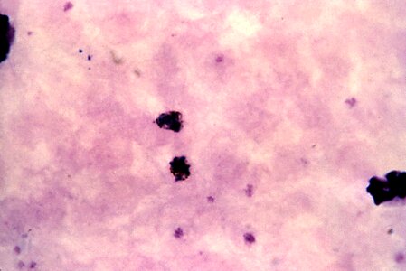 Blood cervical smear film