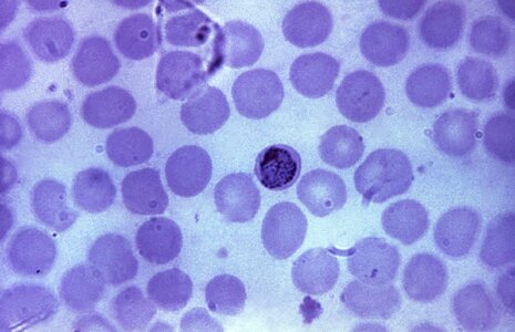 Crescent film plasmodium photo