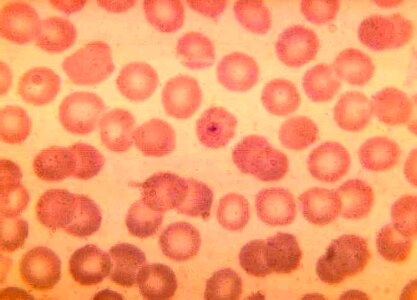 Parasit plasmodium ring photo