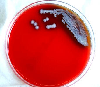 Disease infectious disease 