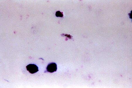 Gametocyte plasmodium photo
