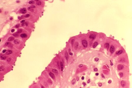 Epithelium gallbladder histopathology