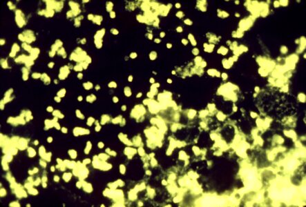 Antibody bacteria photomicrograph photo