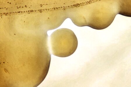 Appearance morphologic 