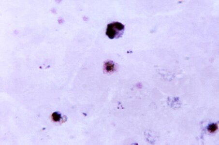 Colorful cytoplasm gametocyte photo