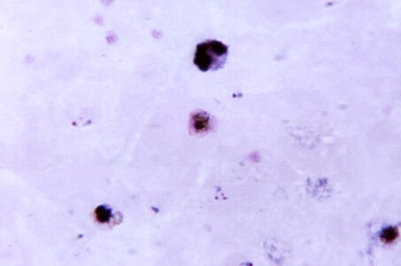 Colorful cytoplasm gametocyte