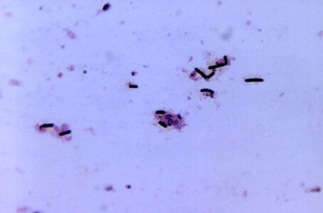 Bacteria clostridium gram photo