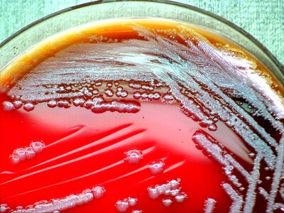 Bacteria blood blood agar photo