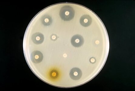 Antibiotic culture example photo