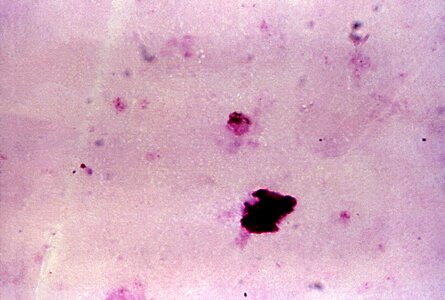 Chromatin gametocyte plasmodium photo