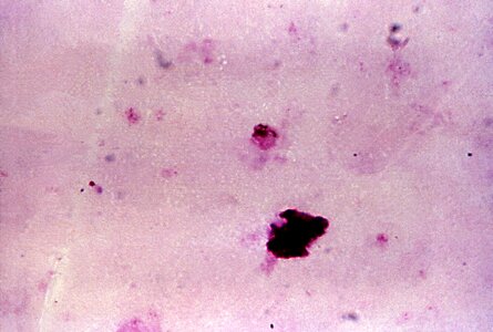 Chromatin gametocyte plasmodium