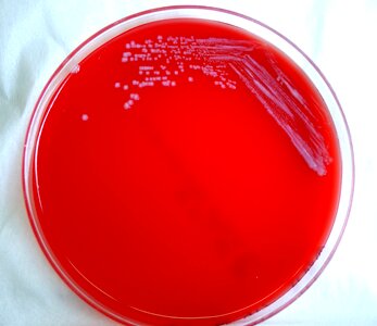 Bacteria colonial gram photo