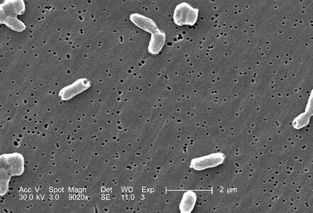 Bacteria gram motile photo