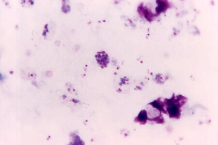 Film magnification scrub