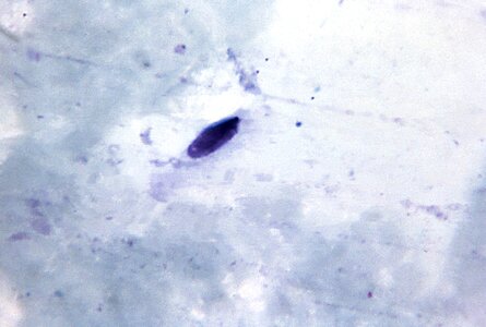 Artifact film gametocyte