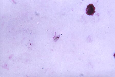 Gametocyte pink plasmodium photo