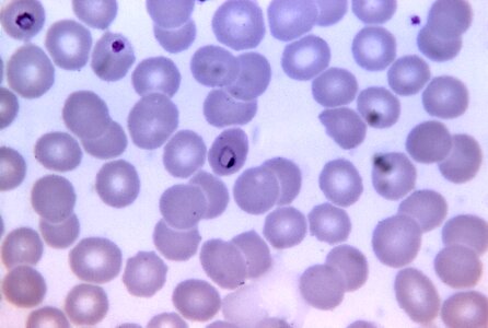 Amount chromatin cytoplasm