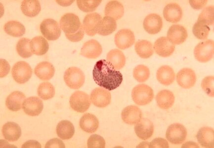 Plasmodium trophozoite photo