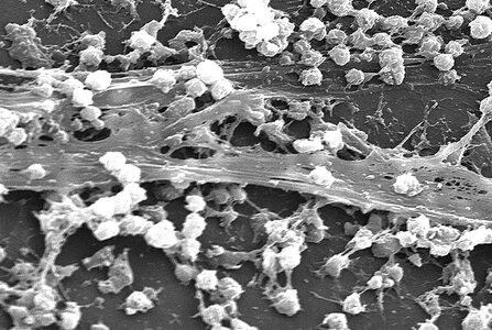 Bacteria electron electron micrograph