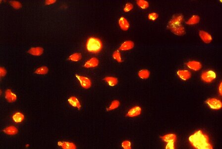 Giardia immunofluorescence proof photo
