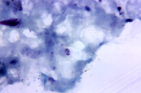 Crescent evidence plasmodium