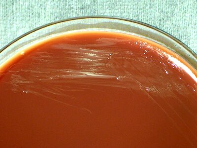 Bacteria brucellosis disease