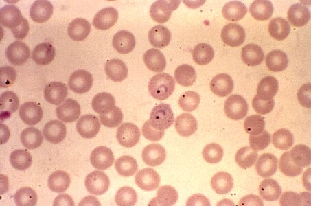 Chromatin cytoplasm plasmodium photo