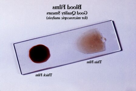 Blood cervical smear estate