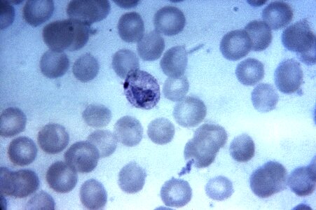 Crescent plasmodium trophozoite photo