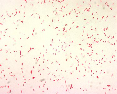 Bacillus gram negative photo
