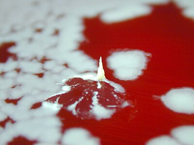 Bacillus blood blood agar photo