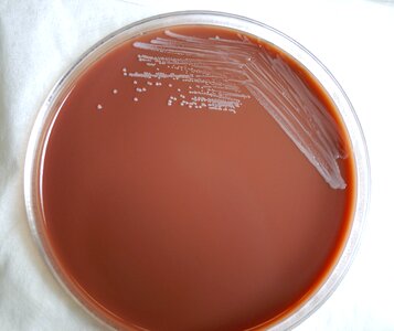 Abortus bacteria contents photo