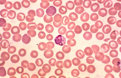 Parasit plasmodium scrub