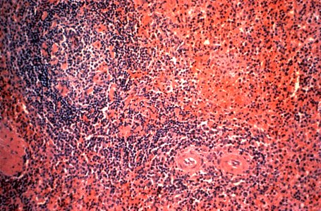 Evening histopathology note