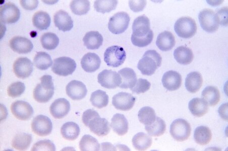 Chromatin cytoplasm rings