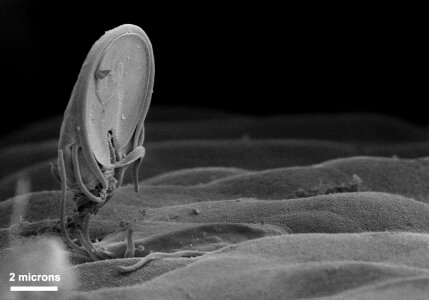 Giardia intestine position